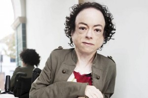 Liz Carr